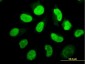 EIF2AK2 Antibody (monoclonal) (M02)